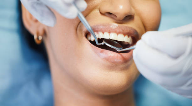 Best Emergency Root Canal Treatment in Pompano Beach, FL